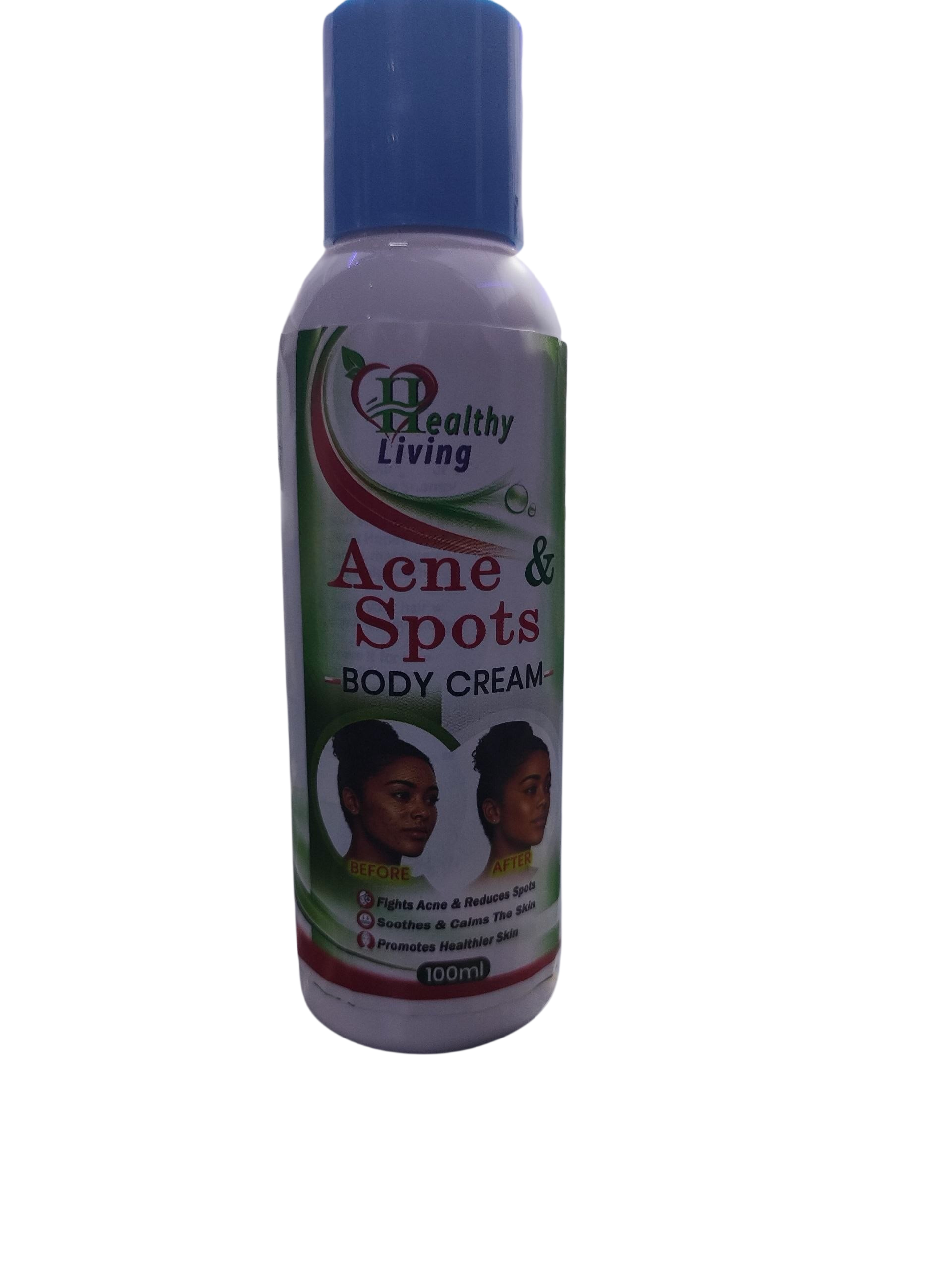 Acne & Spots Body Cream – 100ml